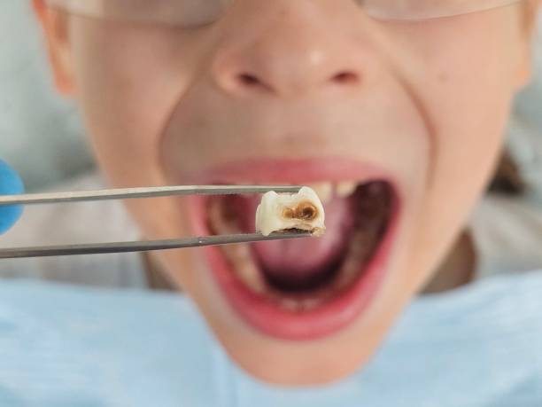 Best Pediatric Emergency Dentist in Timberline Fernwood, AZ